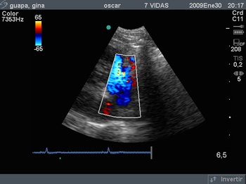 Cardiología